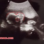 【27週】性別確定！7カ月後半！中期最後の妊婦健診と性別判断の胎児のエコー写真