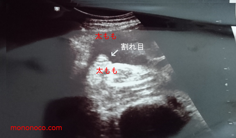 27週 性別確定 7カ月後半 中期最後の妊婦健診と性別判断の胎児のエコー写真 らくがきクリエイトmononoco