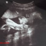 【27週】性別確定!7カ月後半!中期最後の妊婦健診と性別判断の胎児のエコー写真