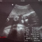 【31週】夫婦で考えようバースプラン！出産の準備の書類をもらってきました@妊婦健診