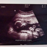 【4人目】橋本病患いの高齢妊婦の21週妊婦健診。性別確認と体重管理